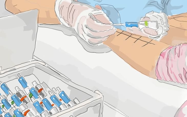 Diagnostik Haselnussallergie