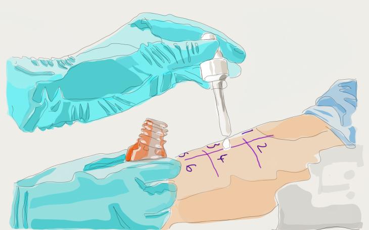 Diagnose Hausstauballergie