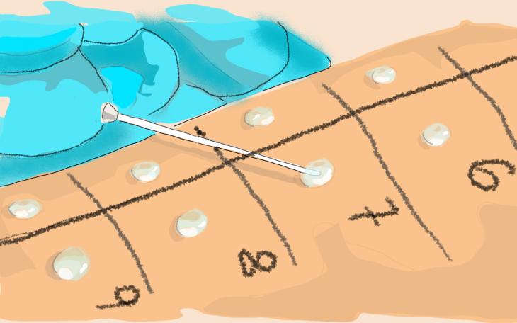 Diagnose Nickelallergie