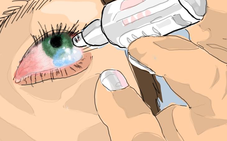 Augenlidentzündung Behandlung