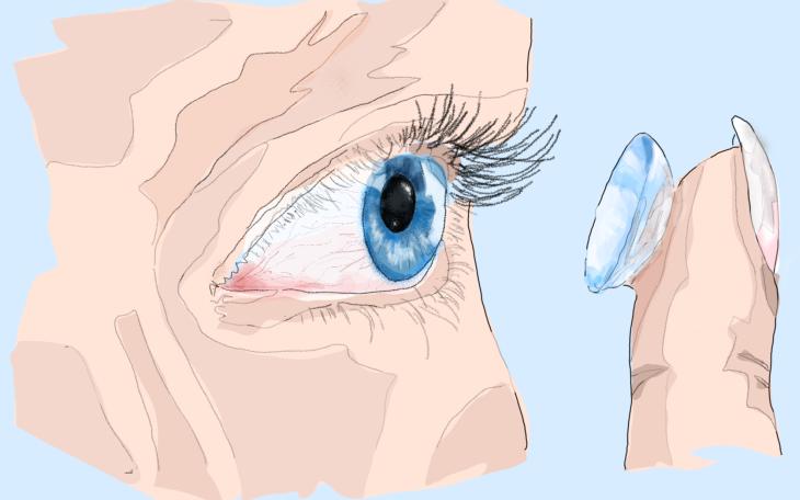 Kontaktlinsen als Auslöser trockener Augen