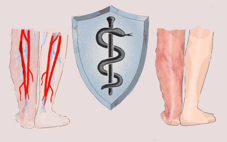 Thrombophilie Behandlung