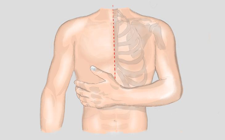 Erkrankungen und Verletzung der Brust und Rippen