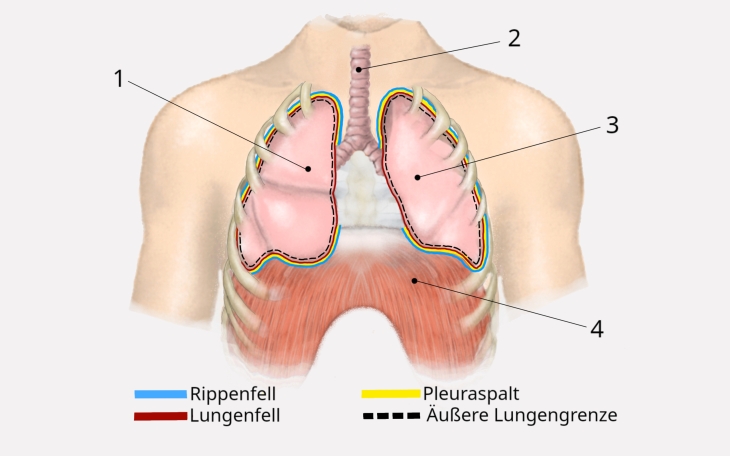 Lokalisation Rippenfellentzündung