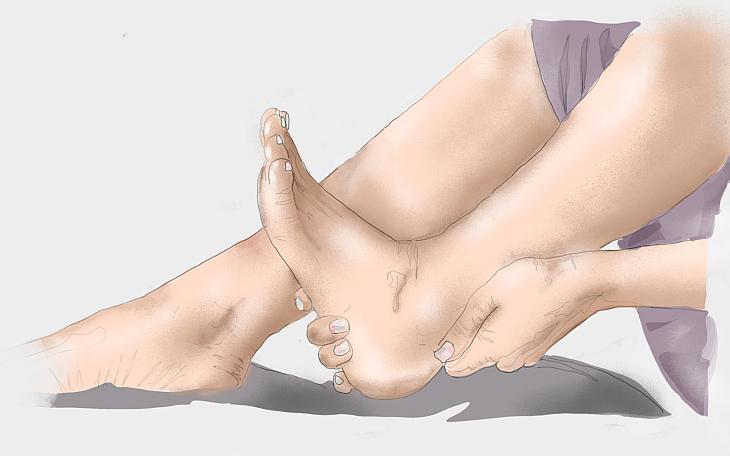 Achillessehnenentzündung Hausmittel