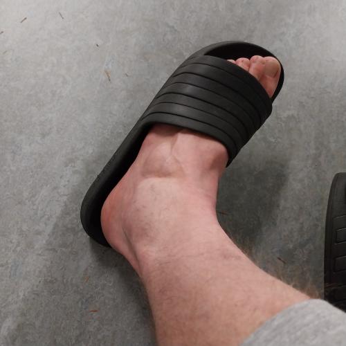 Bild eines Users zum Thema Bänderriss im Sprunggelenk