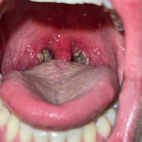 Bild eines Users zum Thema Mandelsteine