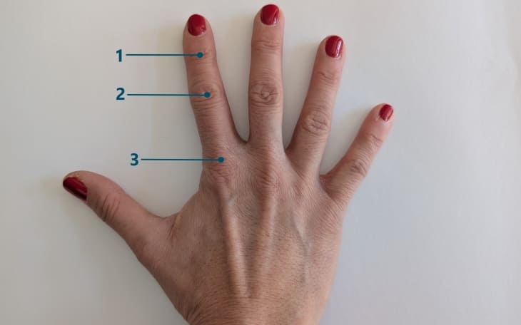 Lokalisation Abriss Strecksehne Finger