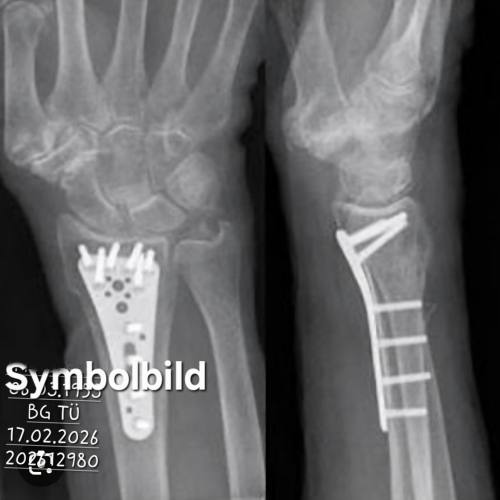 Bild eines Users zum Thema Distale Radiusfraktur