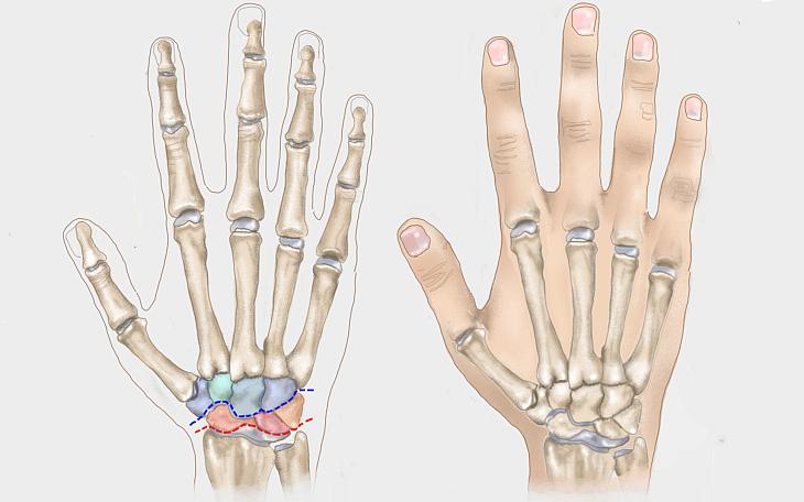 Erkrankungen der Hand und Finger