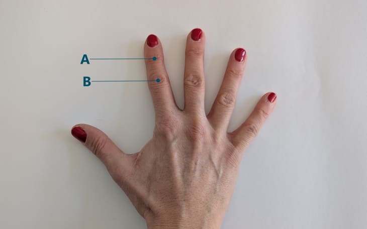 Lokalisation Fingerarthrose