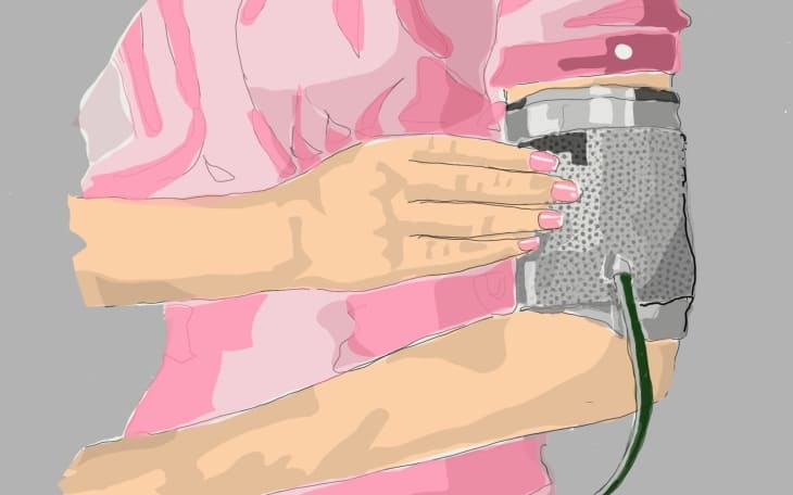 Nierenarterienstenose Anzeichen