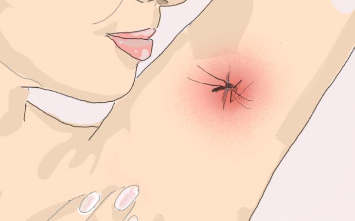 Dengue-Fieber Insektenstich Dengue-Fieber Insektenstich