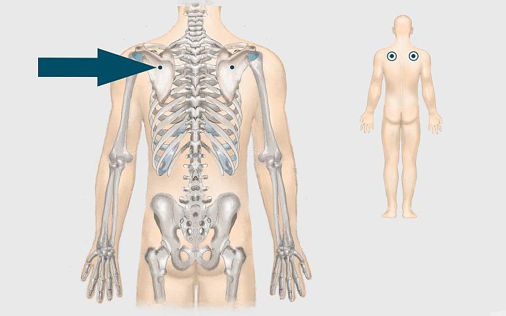 Lokalisation Schmerzen im Schulterblatt