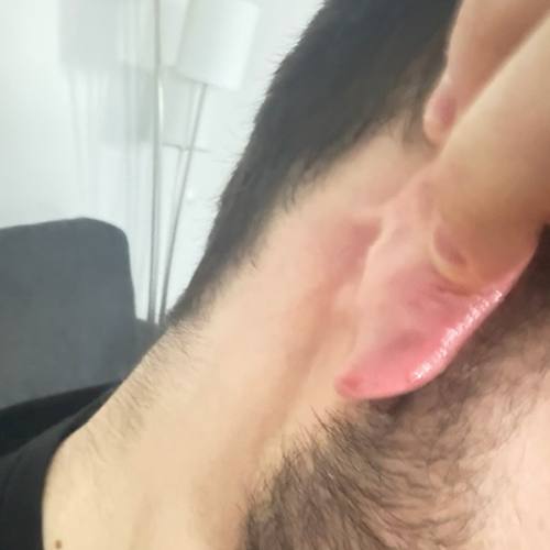 Bild eines Users zum Thema Entzündung der Ohrläppchen