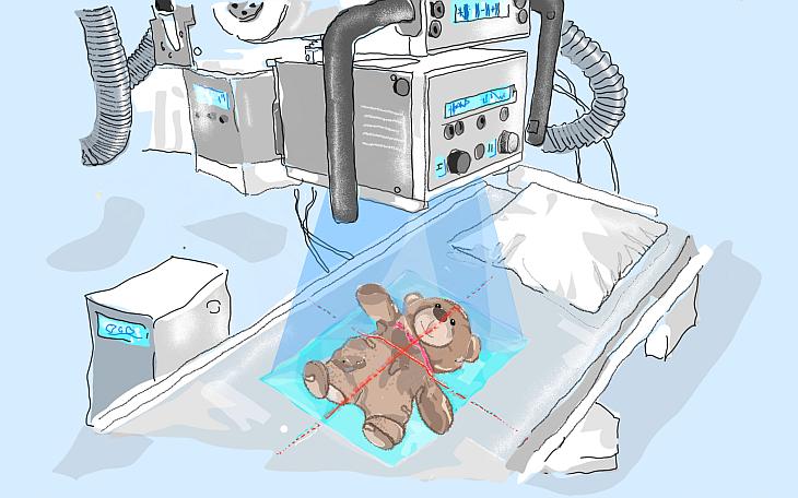 Hyperparathyreoidismus Knochenbruch