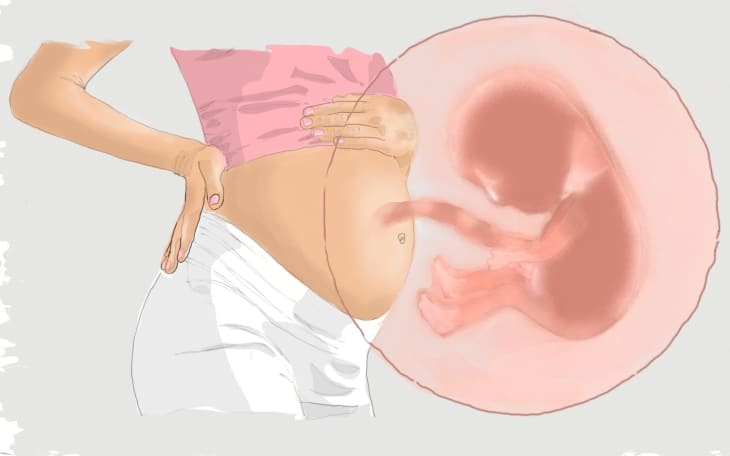 Diphallie Entstehung