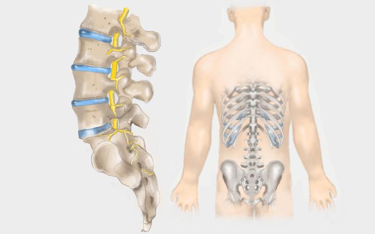 Morbus Baastrup Bild gesund