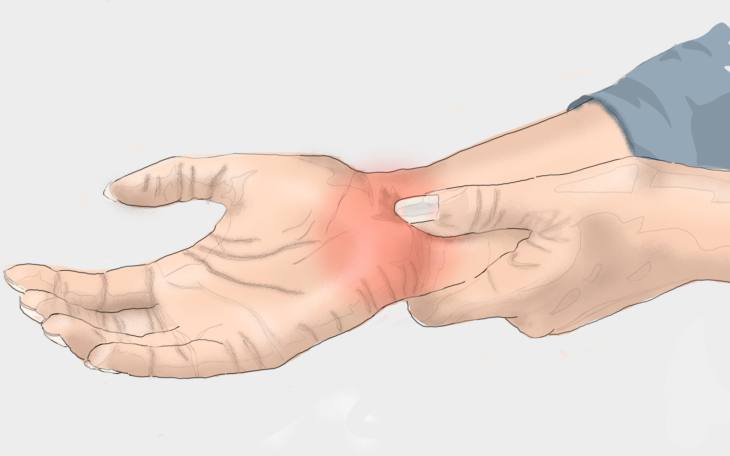 funikulären Myelose Anzeichen