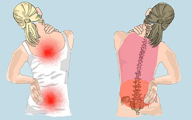Symptome am Rücken