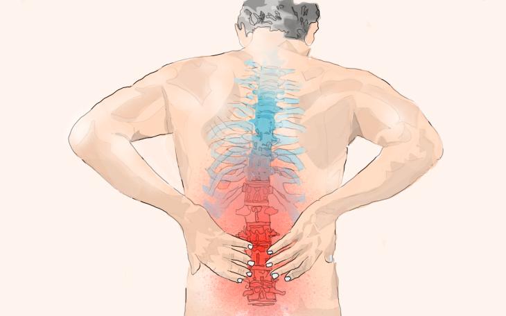 Rundrücken Rückenschmerzen