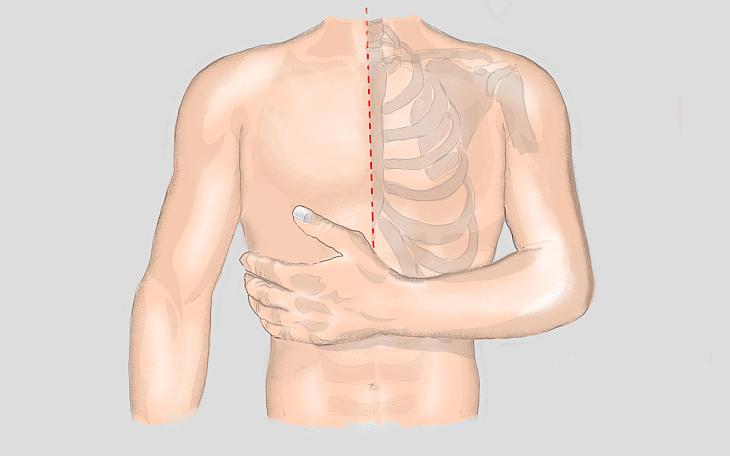 Symptome Brust