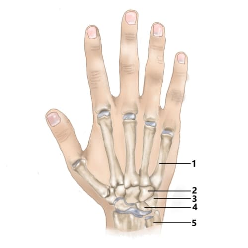 Bild eines Users zum Thema Schmerzen Handgelenk außen