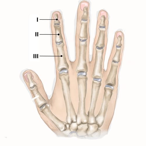 Bild eines Users zum Thema Schmerzen im Zeigefinger