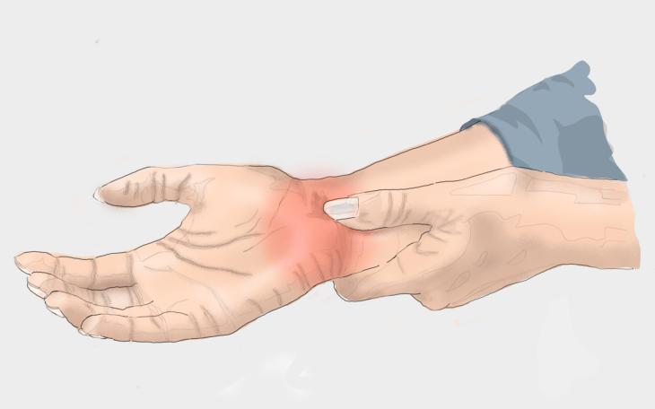 Symptome der Hand