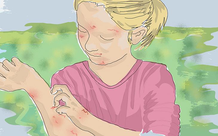 Waschmittelallergie Allergische Reaktion Haut Waschmittel www.docset.de