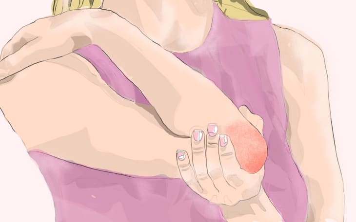 Ausschläge an den Ellenbogen