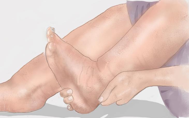 Durchblutungsstörung Anzeichen