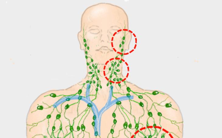 Schmerzen hinter dem Ohr"