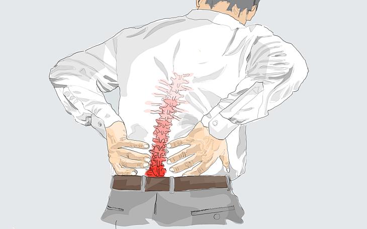 Wirbelgleiten Rückenschmerzen