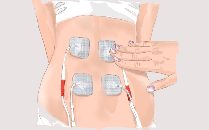 EMG bei Rückenverspannung