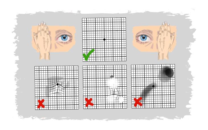 Das Amsler Gitter - ein kurzer Test, der viel verrät