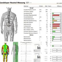 Wirbelsäulenvermessung Ellenbogenarthrose