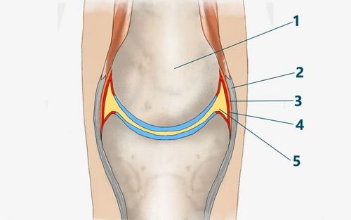 Bild eines Users zum Thema Kapselriss Finger