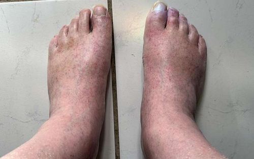 Bild eines Users zum Thema Röteln