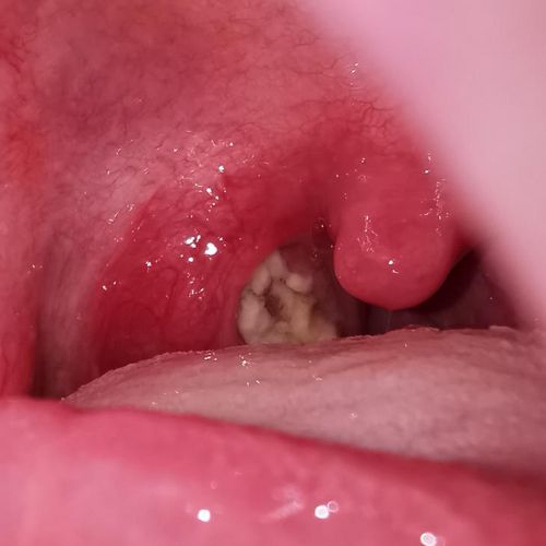 Bild eines Users zum Thema Mandelsteine