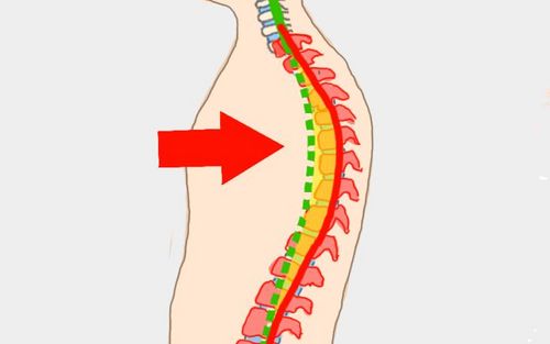 Bild eines Users zum Thema Rundrücken