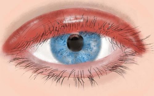 Bild eines Users zum Thema Augenlidentzündung