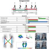 Laufbandanalyse Läuferknie