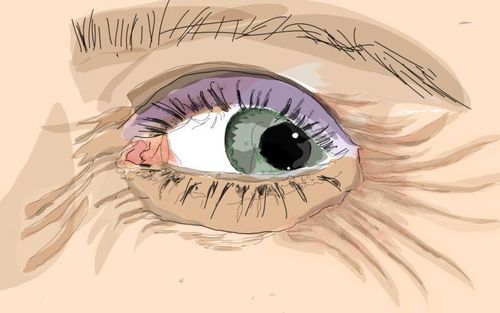 Bild eines Users zum Thema Krähenfüße